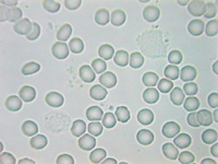 サラサラ血液顕微鏡写真